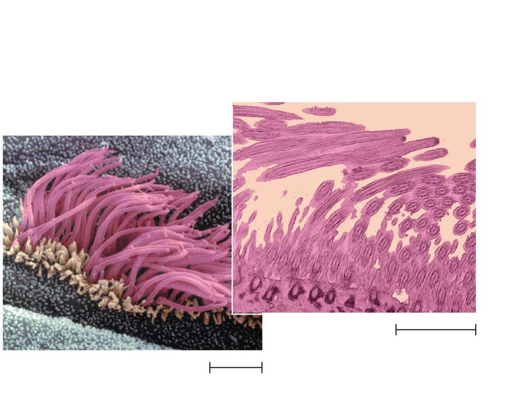 3-3 Electron Microscopy (EM) Cilia Longitudinal section of cilium