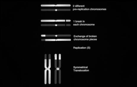 Chromosomal Translocations Links between chromosomal aberrations and cancer Deletion Loss of tumor suppressor gene Translocation or Inversion Activation of an oncogene or creation of fusion gene What