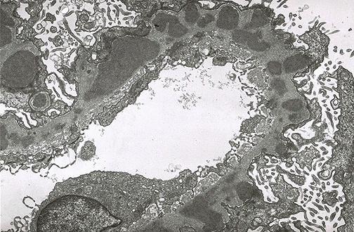 Questions for everyone to consider: Does this glomerulus look normal? If not, what structures appear altered?