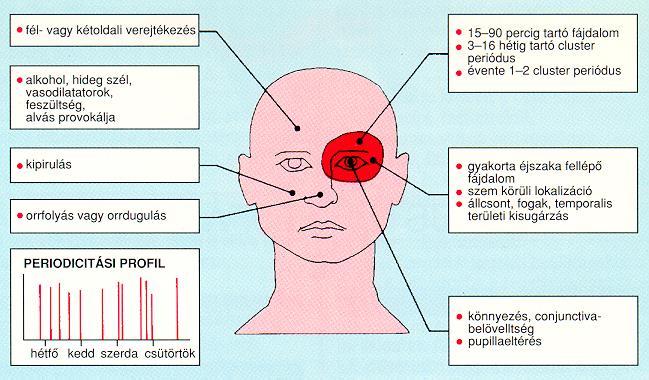 CLUSTER HEADACHE ACCOMPANYING SIGNS UNILATERAL SWEATING ALCOHOL, COLD WIND, VASODILATORS, ANXIETY, BUT ALSO SLEEP PROVOKE CLUSTER ATTACK DURATION OF AN ATTACK: 15-180 MINUTES; DURATION OF A CLUSTER