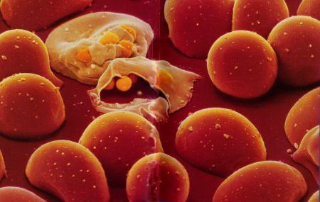 Heterozygote advantage Malaria single-celled eukaryote parasite spends part of its