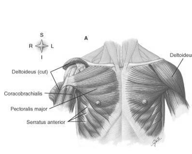Parallel to long axis Horizontal: Transversus abdominis Vertical