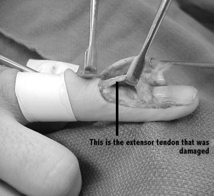 Have a lining of synovial membrane which allows easy movement of the tendon.