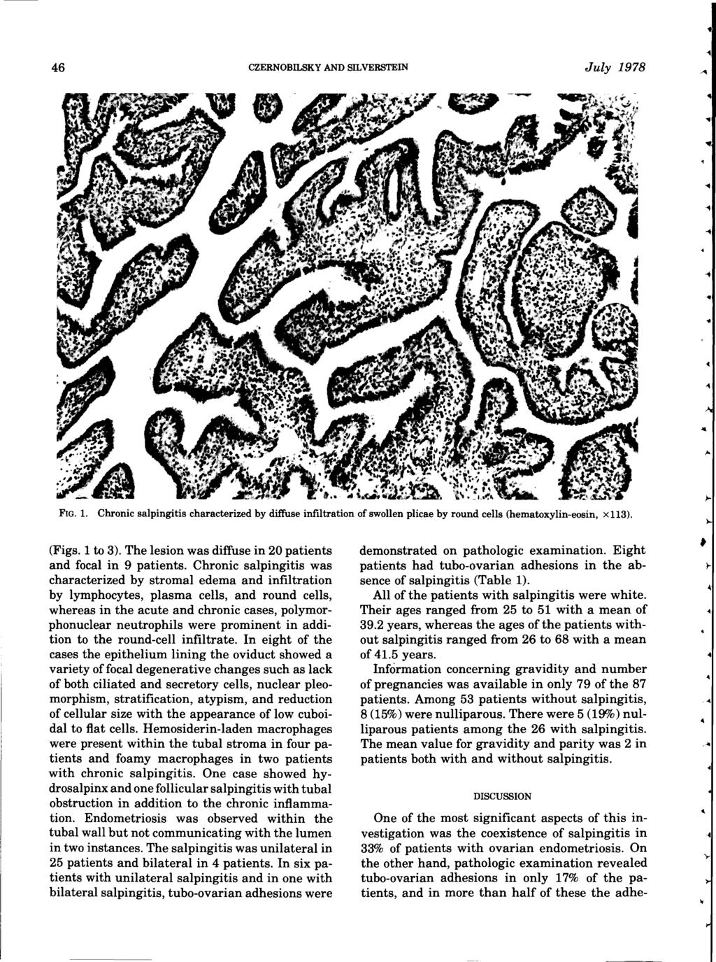 . 46 CZERNOBILSKY AND SILVERSTEIN July 1978 FIG. 1. Chronic salpingitis characterized by diffuse infiltration of swollen plicae by round cells (hematoxylin-eosin, x 113). (Figs. 1 to 3).