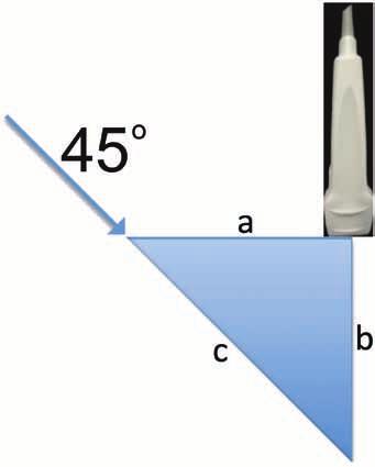Figure 34 Estimation of line placement using right triangle geometry. When using a 45-degree angle, depth equals distance away from the center of the probe.