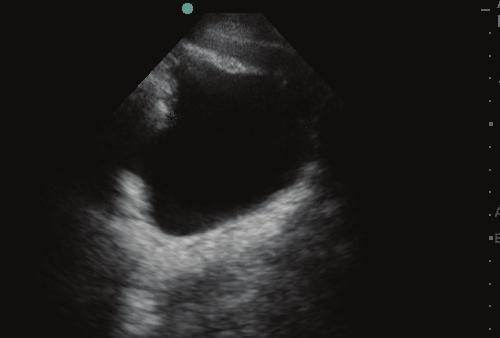Information on contractility, presence, or absence of pericardial effusion should be readily apparent.