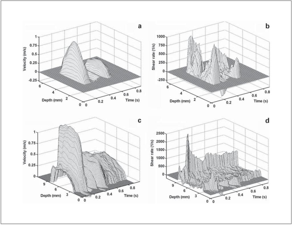 Visualization of haemodynamics with ultrasound Velocity profile