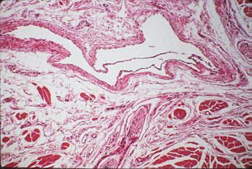 The adventitial layer is thick in large veins and frequently contains longitudinal bundles of smooth muscle.
