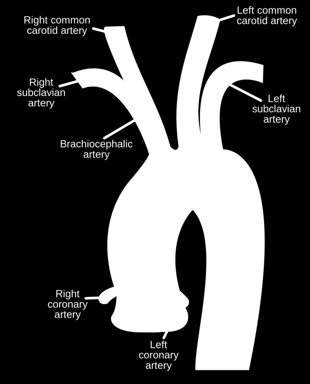 Arch of the aorta branch into: 1-brachiocephalic artery: 5 cm passes to the right