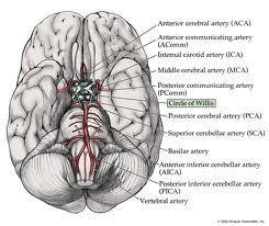 artery and circle of Willis in the brain.