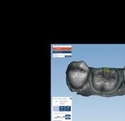 CAD/CAM for dental labs The