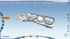 The software is easy and fast to use and is ideal for designing prosthetic works