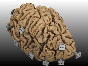 3D models are useful to doctors as non-invasive tools to analyze connectivity, axons and, in general, brain s white matter Annotations