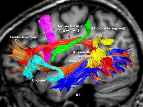 i.e. fascicles) in the WM to understand how information travels across the brain 7 METHODS