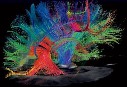 dmri TRACTS measured on real brain TRACTOGRAPHY from dmri has not yet been validated at anatomical level,