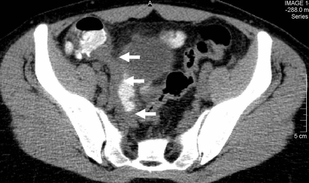of the CT examination 10,11 (Figure 1).