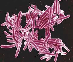 OIs: Bacterial disease o Mycobacterium avium complex or M.