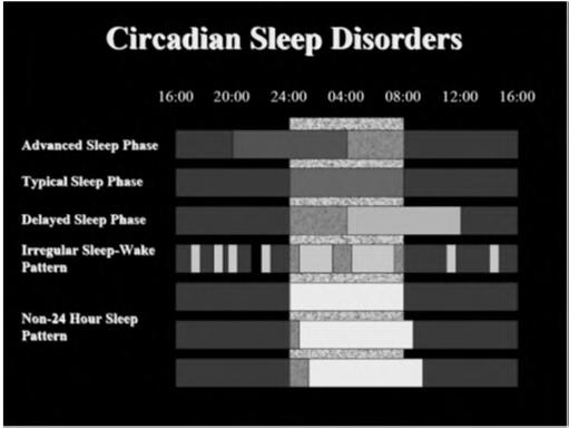 Circadian Rhythm Disorders Delayed Sleep Phase -22 year old