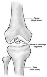 Common Injuries to the Knee 23.