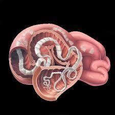 Parasites After a long infection, the tapeworm can become large enough that an infected person can start becoming