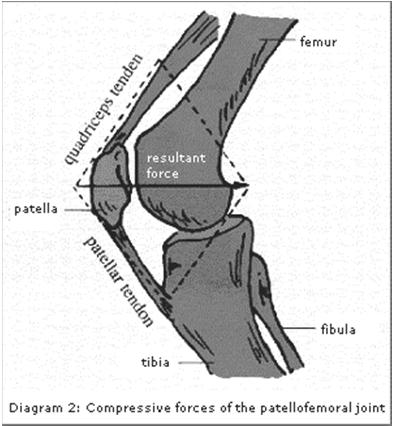 Patellofemoral Joint Stress Quadriceps Strengthening Posterior, superior, lateral Patellofemoral Pain Diminished contact area Elevated joint reaction forces Walking 0.5 body weight Up stairs 2.