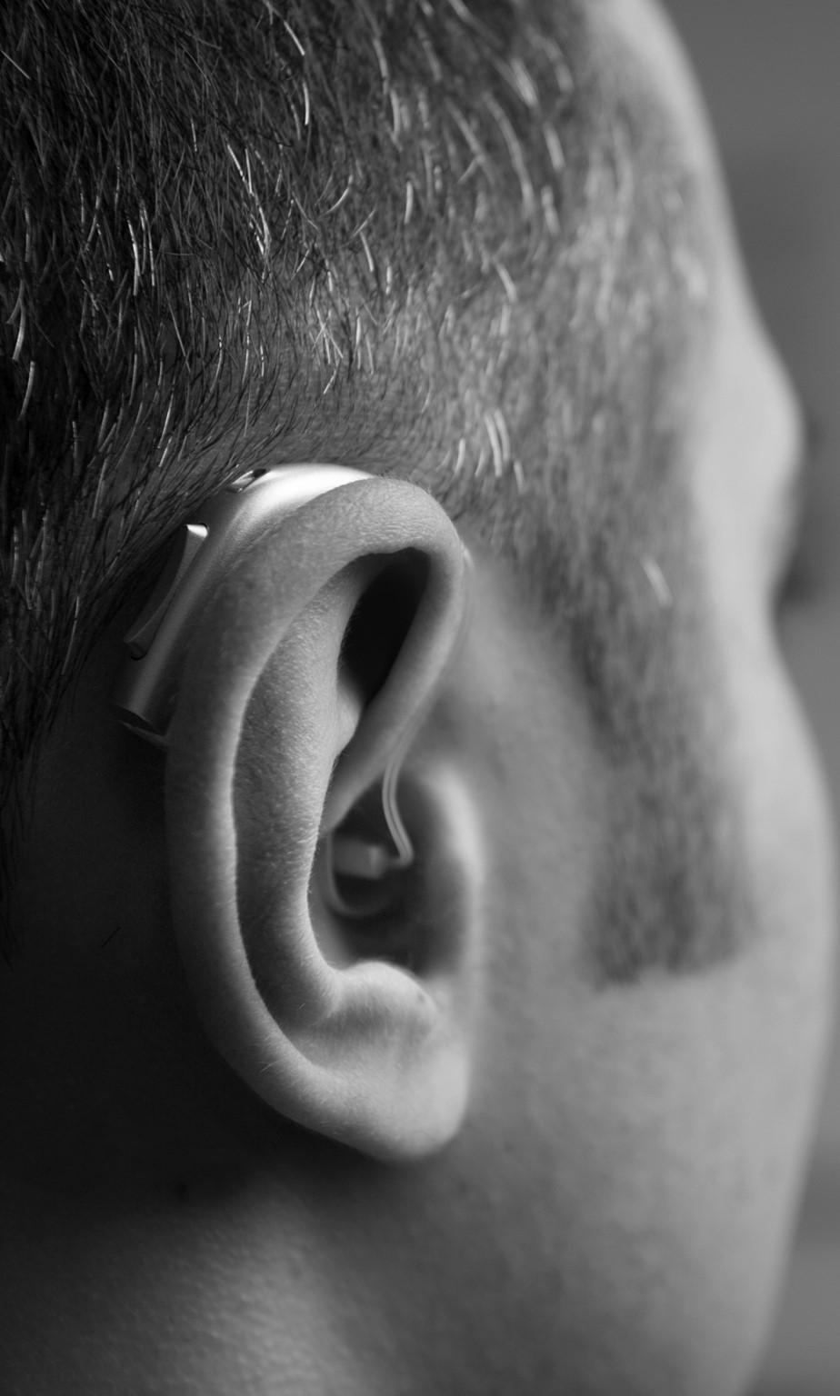 Why do hearing aids not solve the problem?