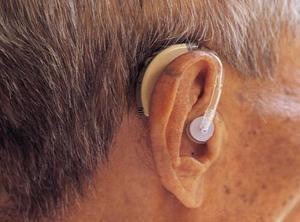 YOUR TURN! The only adequate way address hearing loss is with hearing aids. A. True B. False October 17, 2017 Minnesota Department of Human Services mn.