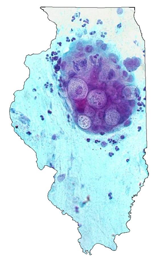 Illinois STD Statistics: Chlamydia 2015 CDC National Chlamydia Data Total Illinois: Ranked 11 th in chlamydia infections by rate per 100,000 population Ranked 5 th by overall by case count Cook