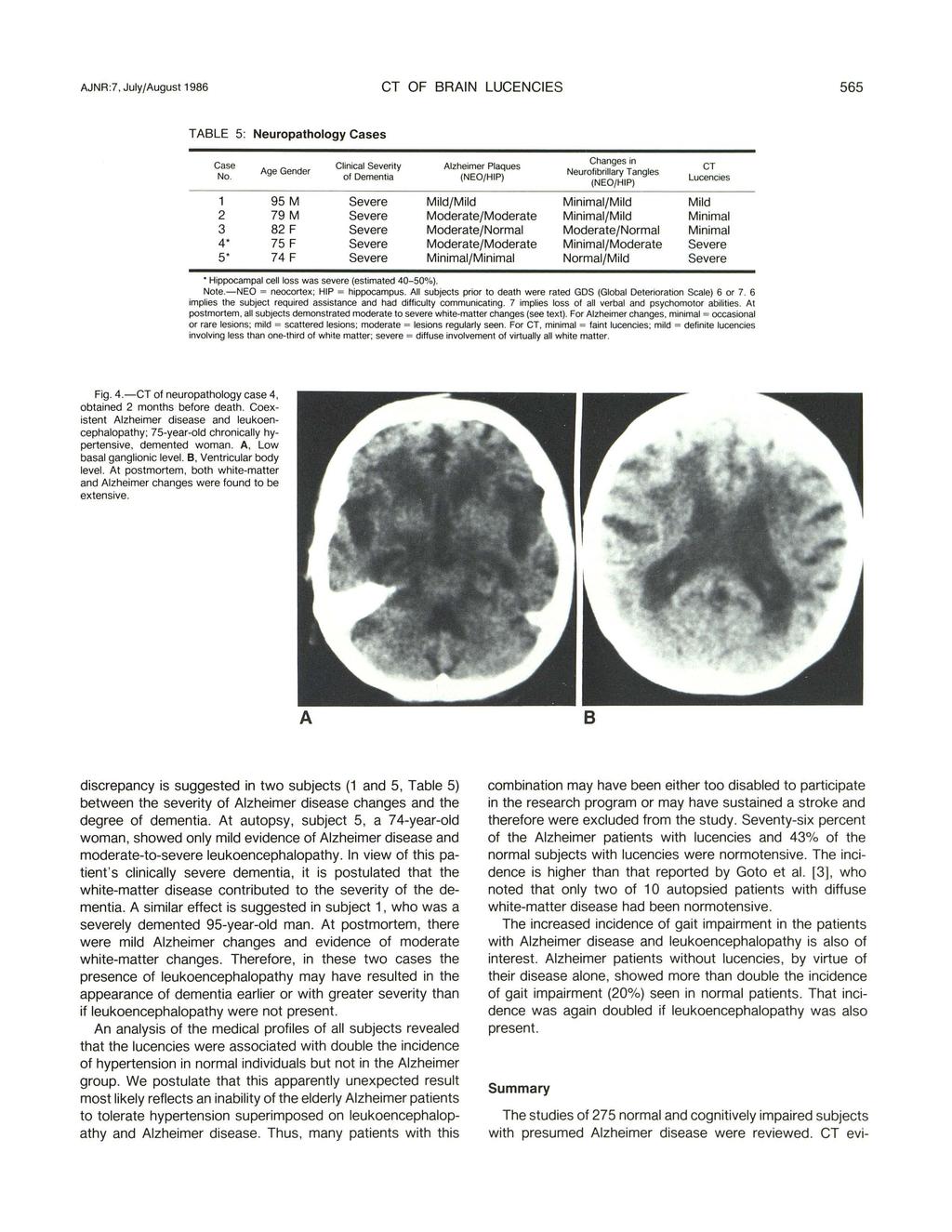 AJNR:7, July/August 1986 CT OF BRAIN LUCENCIES 565 TABLE 5: Neuropathology Cases Case Clinical Severity Alzheimer Plaques Age Gender No.