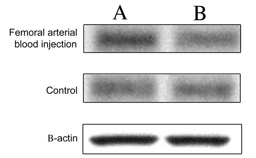 Results-Western Blot A: non-injected side; B: