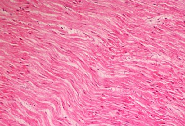 4/4/16 Kids of Muscle 1. Smooth Muscle 3 