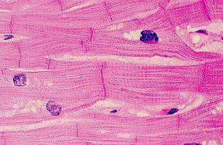 Locatio I digestive tract & blood vessel walls Smooth muscle Cardiac muscle Skeletal muscle Fuctio 2.