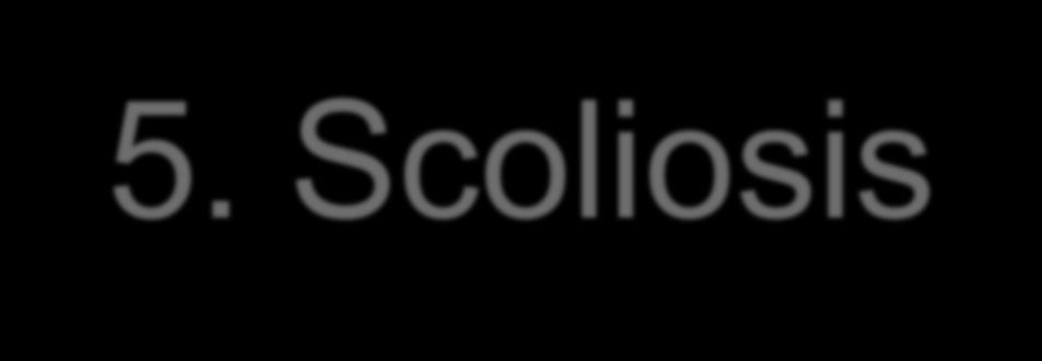 5. Scoliosis Scoliosis