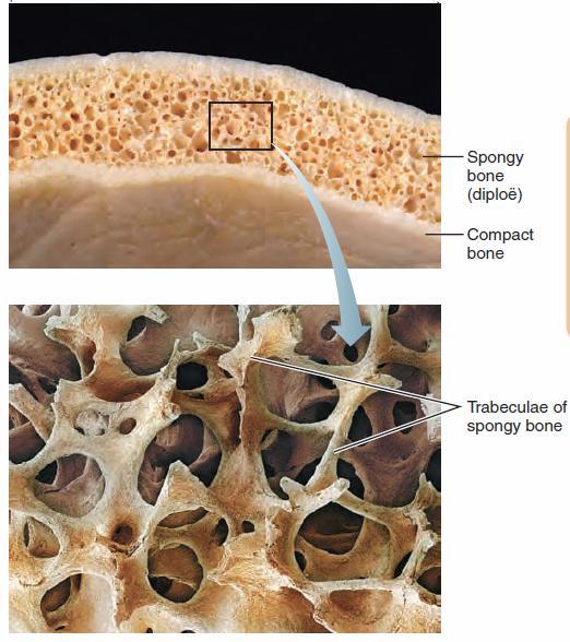 Microscopic Anatomy of Spongy Bone The trabeculae in spongy bone