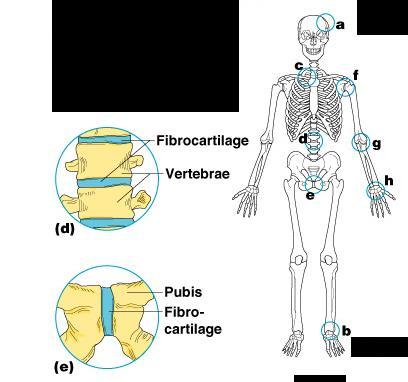 Cartilaginous Joints Bones connected by cartilage