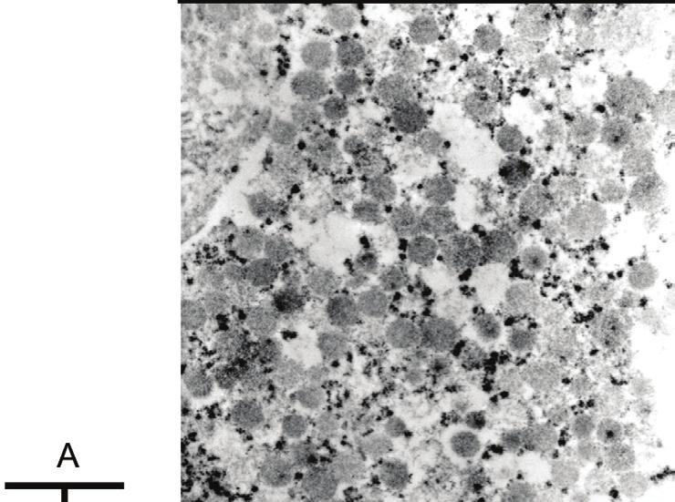 No direct reactivity for dense-core granules was evident (Fig. 5). DISCUSSION In the present study, we found a 3-4% frequency of cytoplasmic HER2 staining.