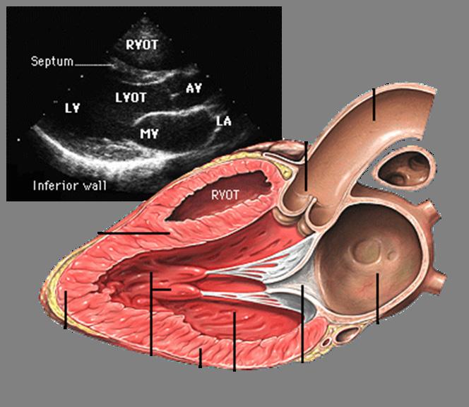 Aortic arch Aortic valve RVOT Septum