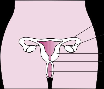 What is cervical cancer? Cervical cancer develops in the cervix (the entrance to the womb see diagram below). It is caused by a virus called the human papillomavirus or HPV.