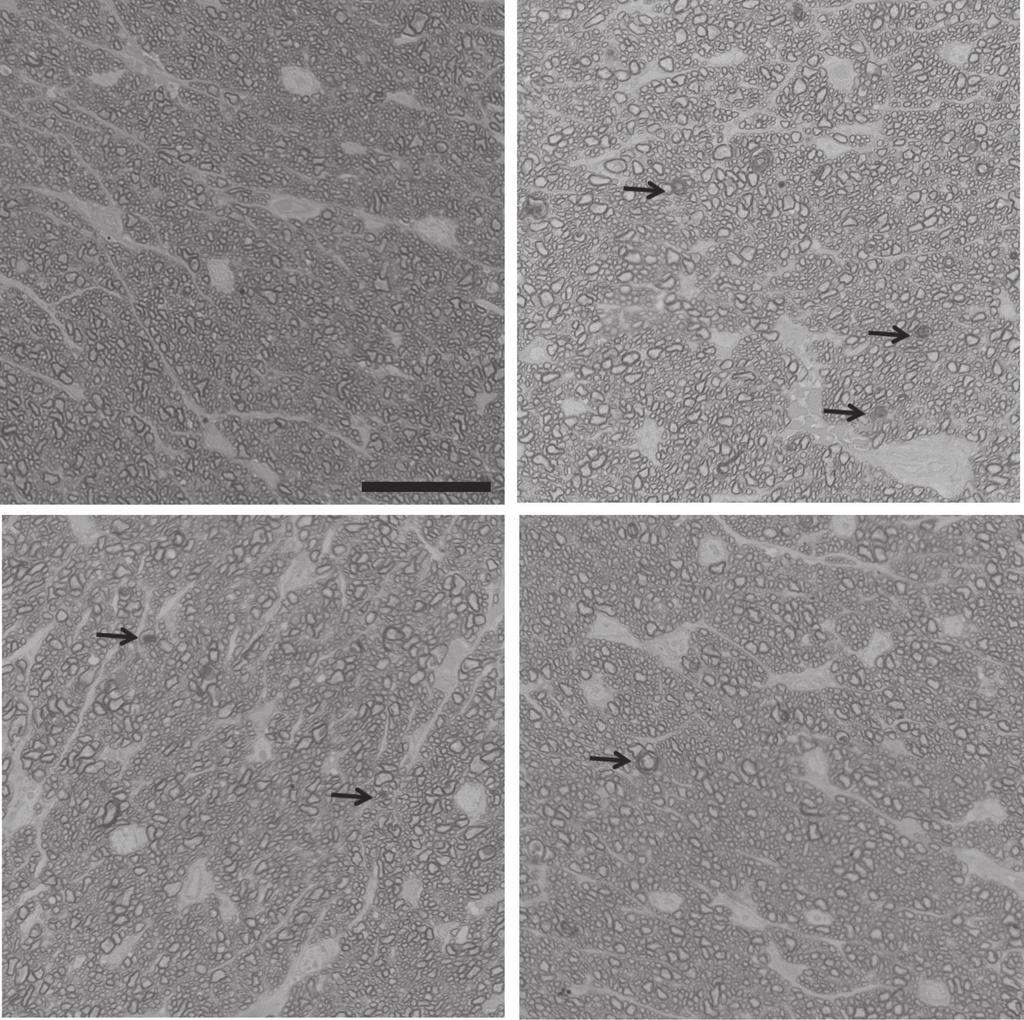 The Amerin Soiety of Gene & Cell Therpy EPO-R76E Protets Aginst Gluom e Degenerting xons (% of totl) 6 4 2 f Totl xons 6, 4, 2, Sline Miroe Sline Miroe Figure 4 Opti nerve histology is preserve 4