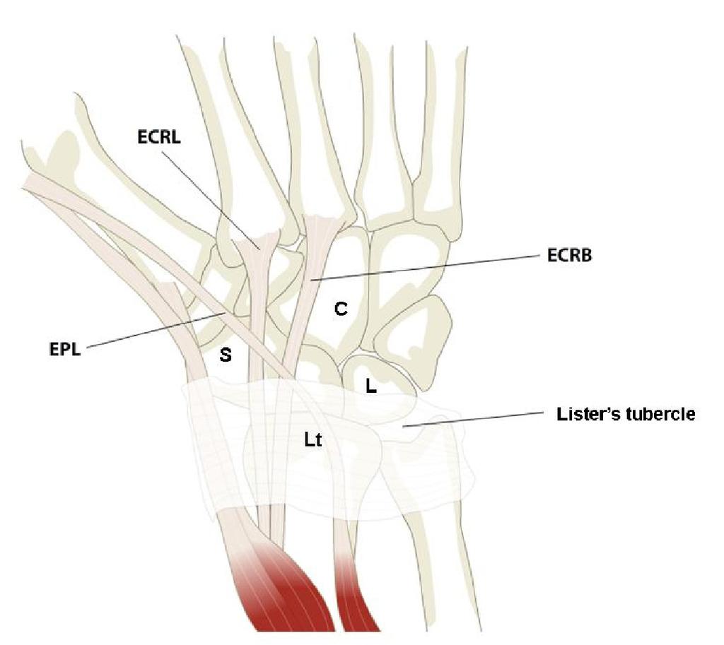 After this time a myriad of different authors started to scrutinize anatomy and biomechanics of the wrist and to describe various operating methods of these instabilities, in particular instability