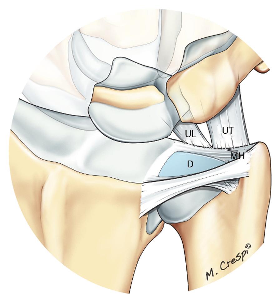 Biomechanics Fig. 7.2 Drawing of the distal portion of the triangular fibrocartilage complex. D, disk; MH, meniscal homologue; UL, ulnolunate ligament; UT, ulnotriquetral ligament.
