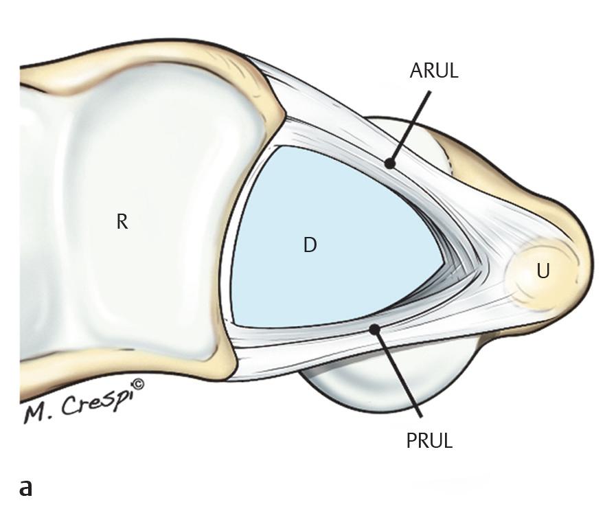 The base of the disk is attached to the sigmoid notch of the radius, whereas the apex is attached to the fovea at the base of the ulnar styloid on the head of the ulna.