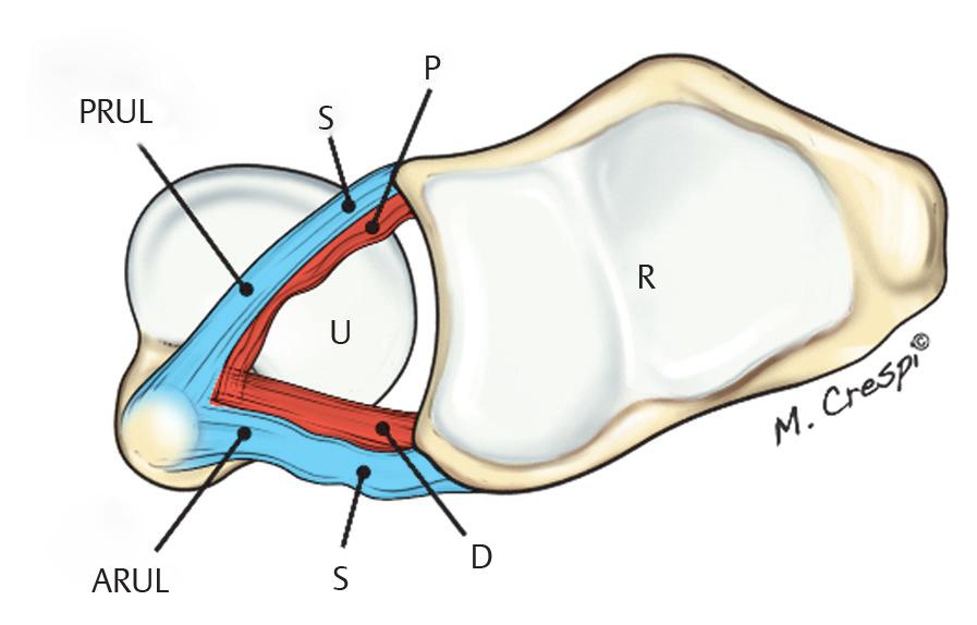 Conclusion Fig. 7.7 Drawing showing the position of the fibers of radioulnar ligaments in wrist pronation.