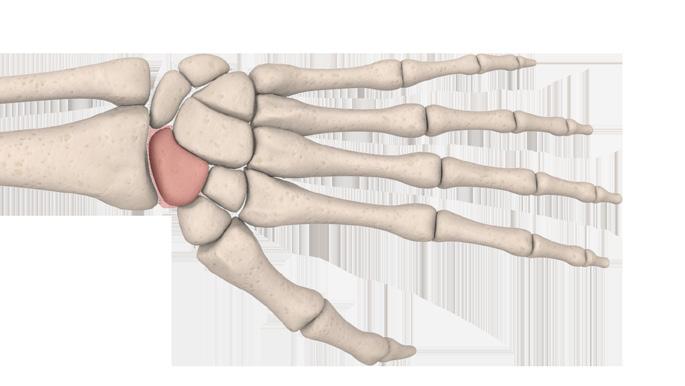 Correct the malalignment of the first row (front and sagittal) of the carpus onto the second row.