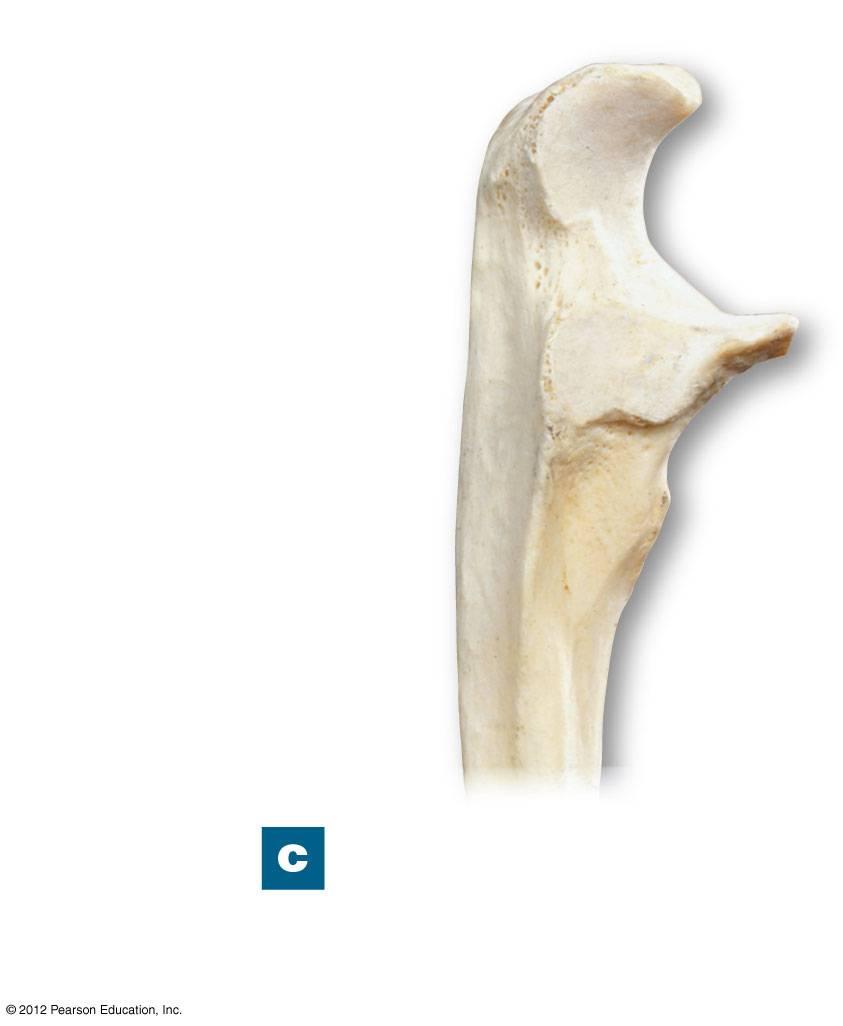 Figure 8-5c The Right Radius and Ulna Olecranon Trochlear notch Coronoid process