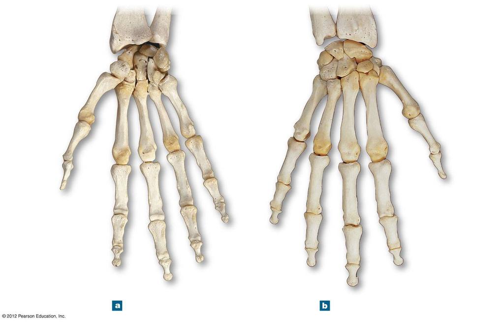 Figure 8-6 Bones of the Right Wrist and Hand RADIUS RADIUS ULNA Lunate Scaphold Lunate Scaphold Triquetrum Trapezium Trapezium Pisiform Trapezoid Capitate Trapezoid I
