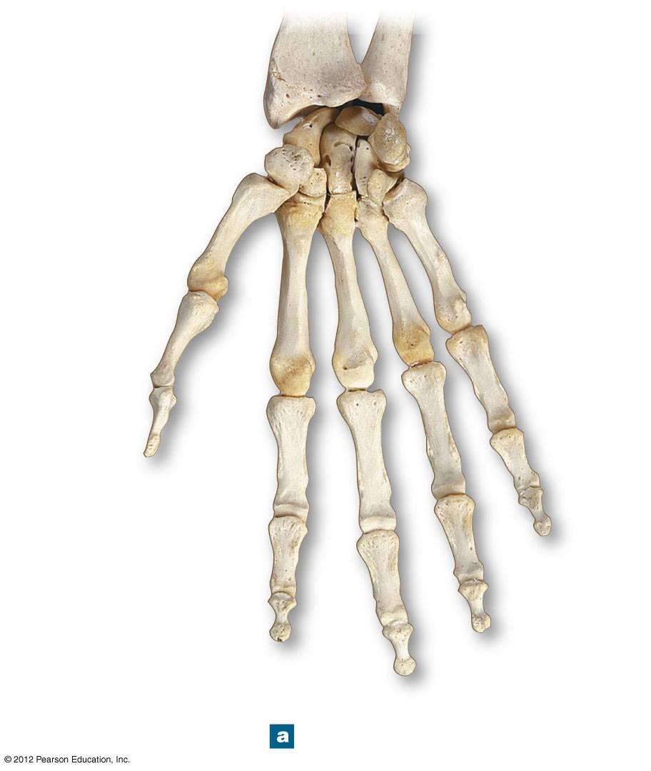 Figure 8-6a Bones of the Right Wrist and Hand RADIUS ULNA Lunate Scaphold Triquetrum Trapezium