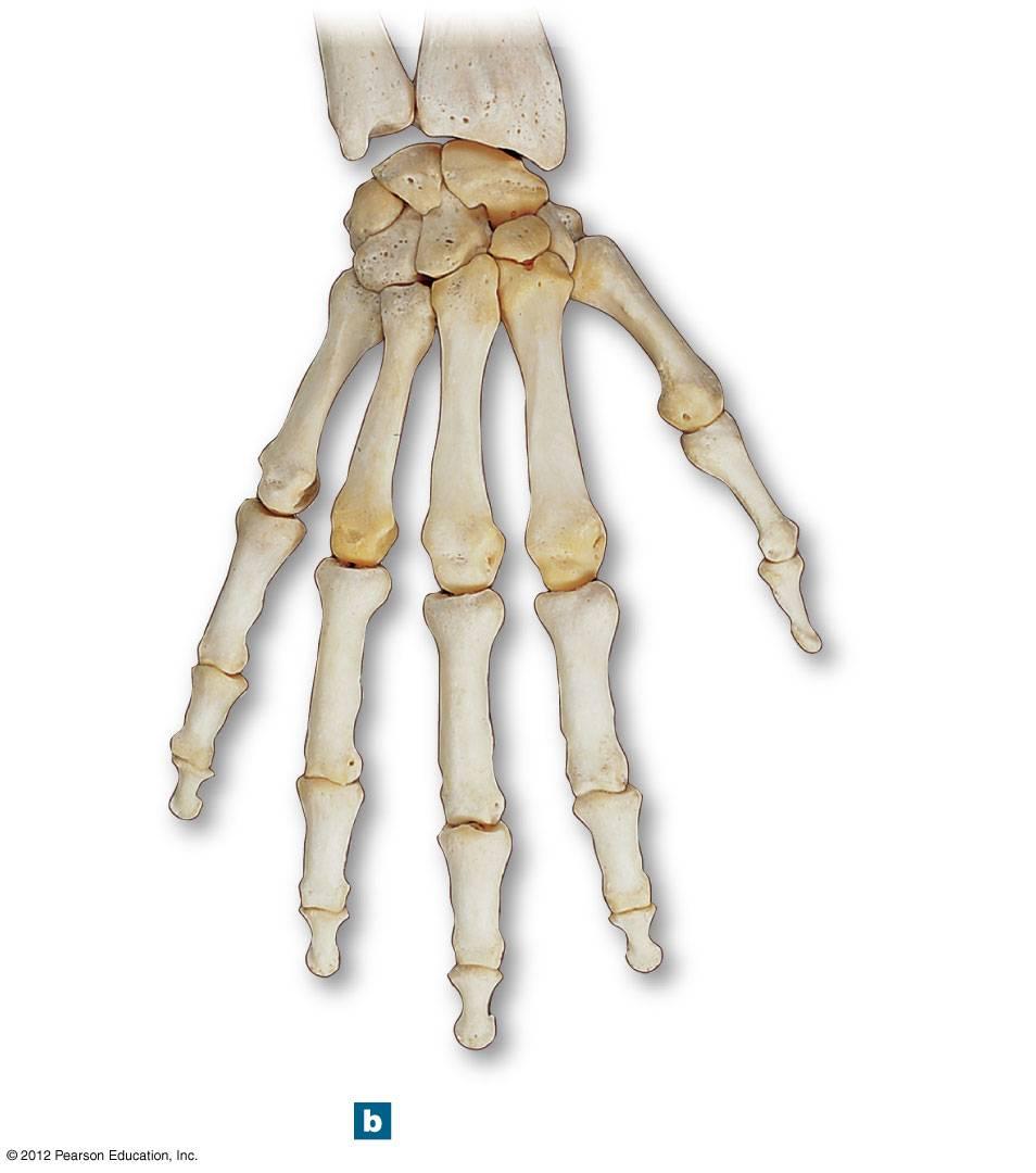 Figure 8-6b Bones of the Right Wrist and Hand RADIUS ULNA Lunate Scaphold Triquetrum Trapezium Pisiform