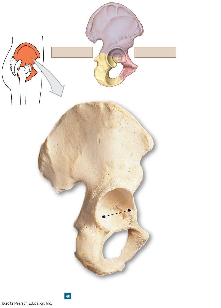 Figure 8-7a The Right Hip Bone Ilium POSTERIOR Ischium ANTERIOR Pubis Iliac crest Anterior gluteal line Anterior superior iliac spine Posterior gluteal line Inferior gluteal line Posterior superior