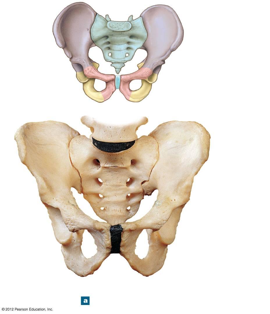 Figure 8-8a The Pelvis of an Adult Male SACRUM COCCYX ILIUM PUBIS Hip bone (Figure 8 7) ISCHIUM Iliac crest L5 Iliac fossa
